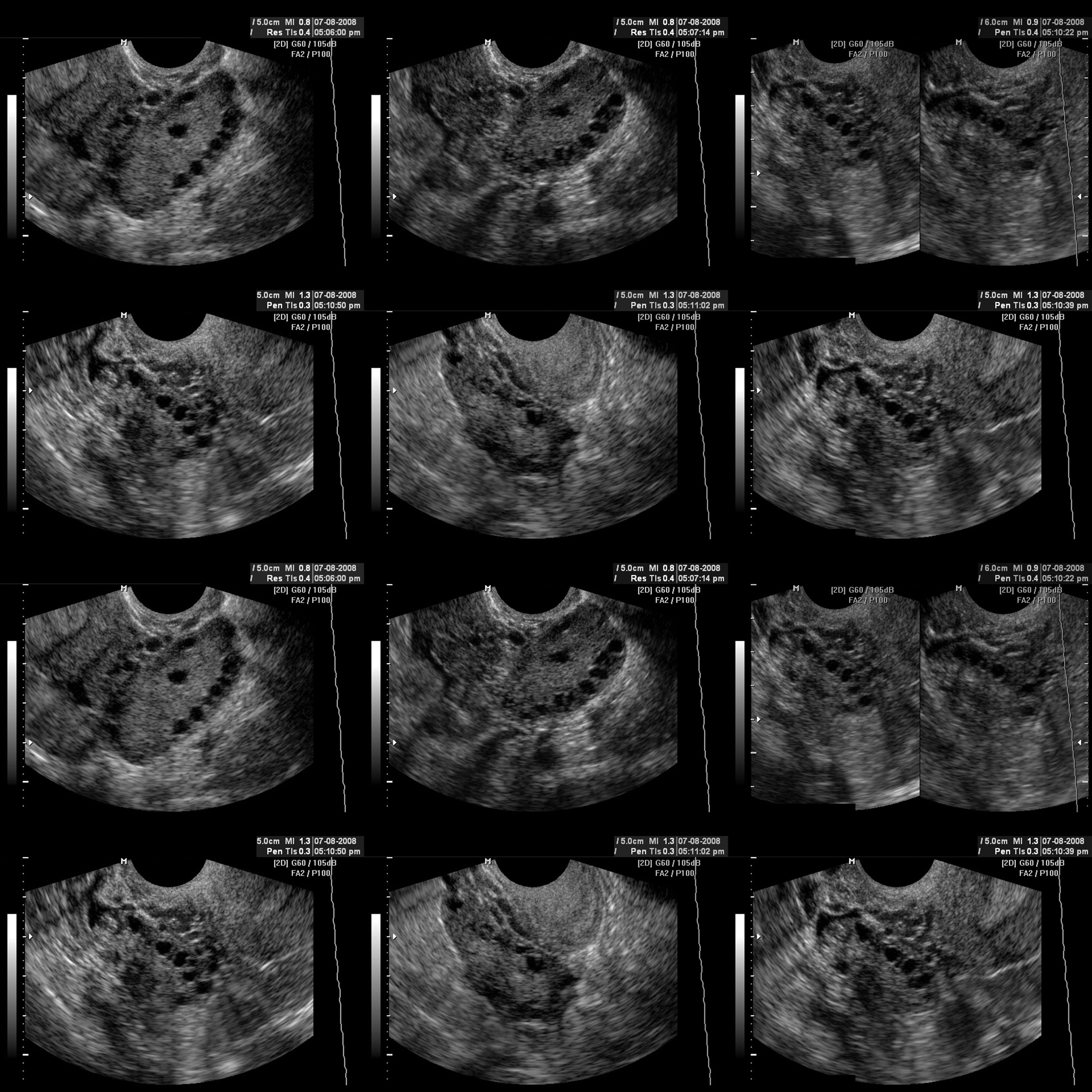 Een tekening van een oude indeling van de mensheid in vijf hoofdrassen: naast Kaukasisch, Mongoloïde en Negroïde, ook Polynesisch en Indiaans.