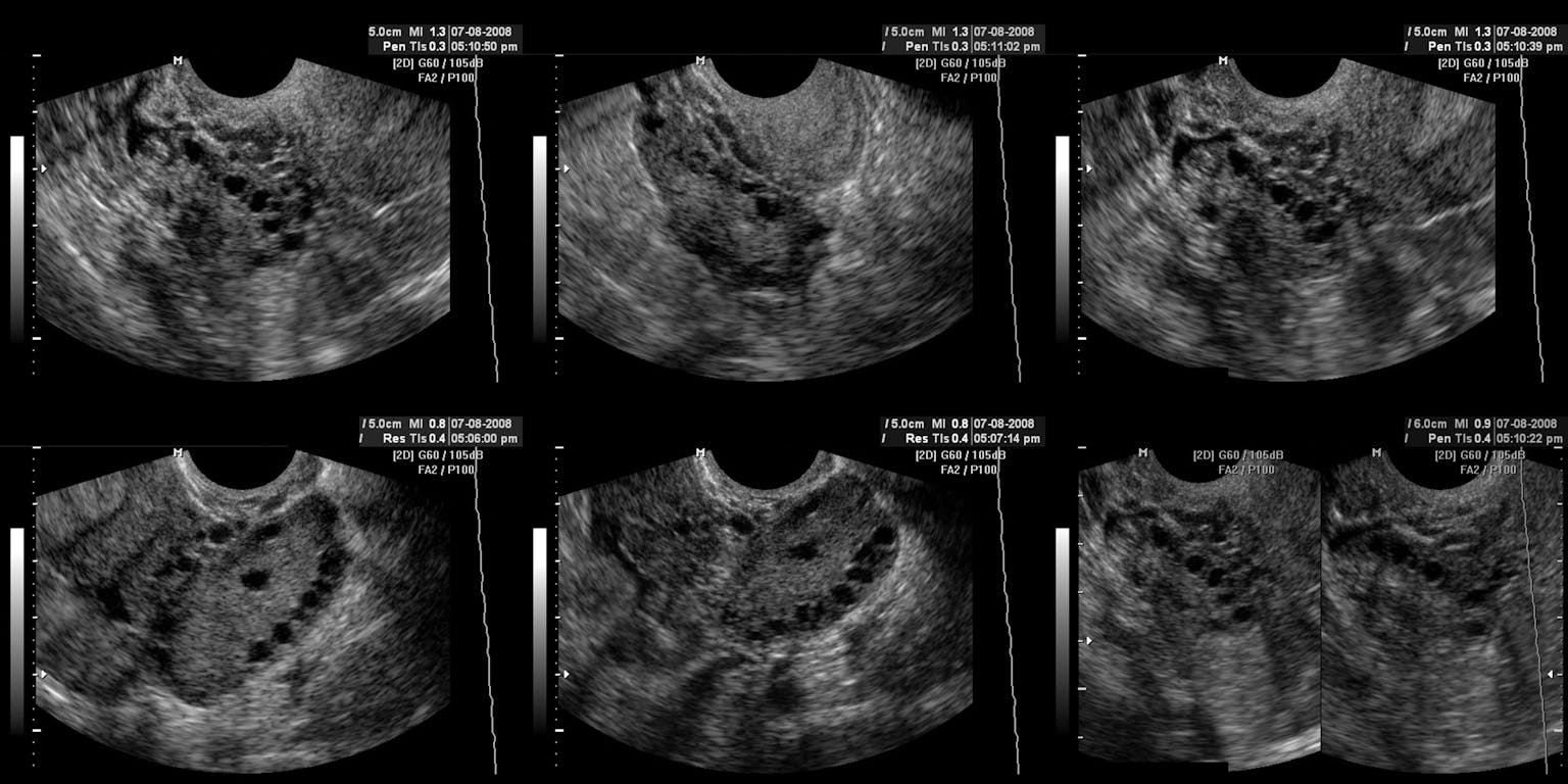 Een tekening van een oude indeling van de mensheid in vijf hoofdrassen: naast Kaukasisch, Mongoloïde en Negroïde, ook Polynesisch en Indiaans.