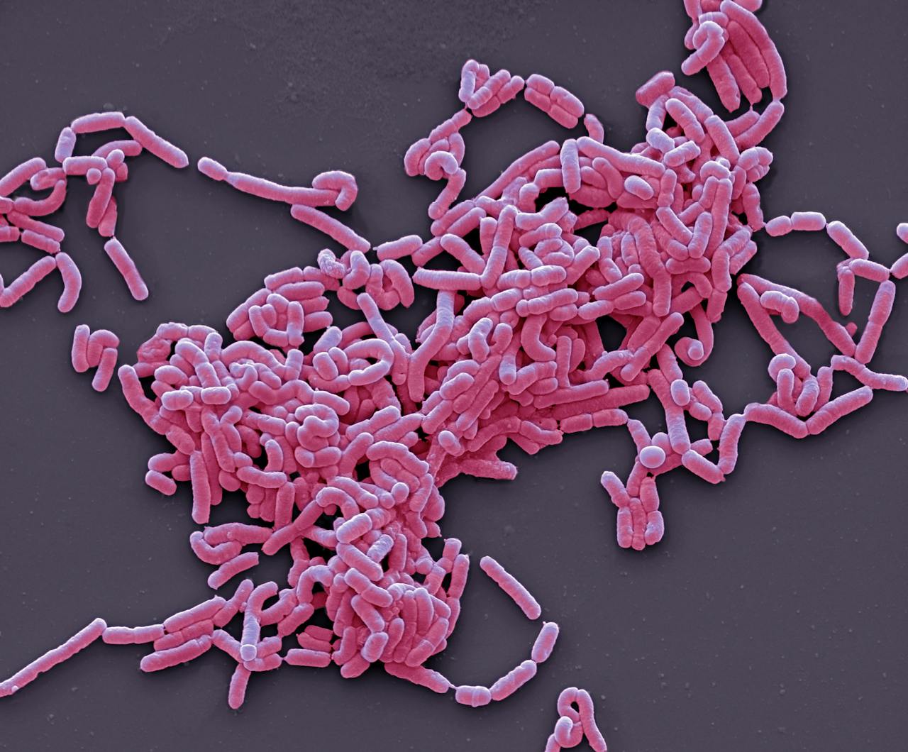 Een close-up van roze melkzuurbacteriën op een zwarte achtergrond.