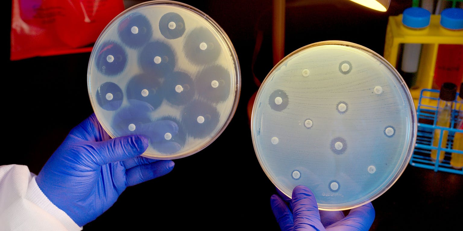 Een antibiogram. De grootte van de cirkels om de gekleurde tabletjes geeft aan in hoeverre een bacterie gevoelig is voor de antibiotica.