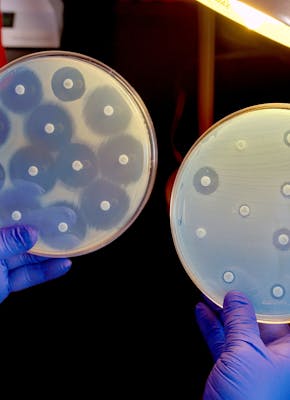 Een antibiogram. De grootte van de cirkels om de gekleurde tabletjes geeft aan in hoeverre een bacterie gevoelig is voor de antibiotica.
