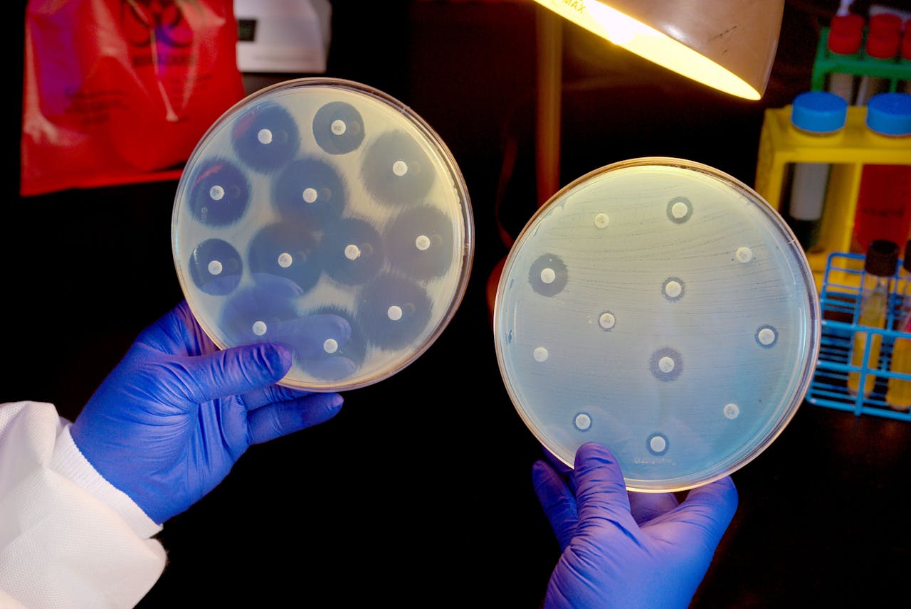 Een antibiogram. De grootte van de cirkels om de gekleurde tabletjes geeft aan in hoeverre een bacterie gevoelig is voor de antibiotica.