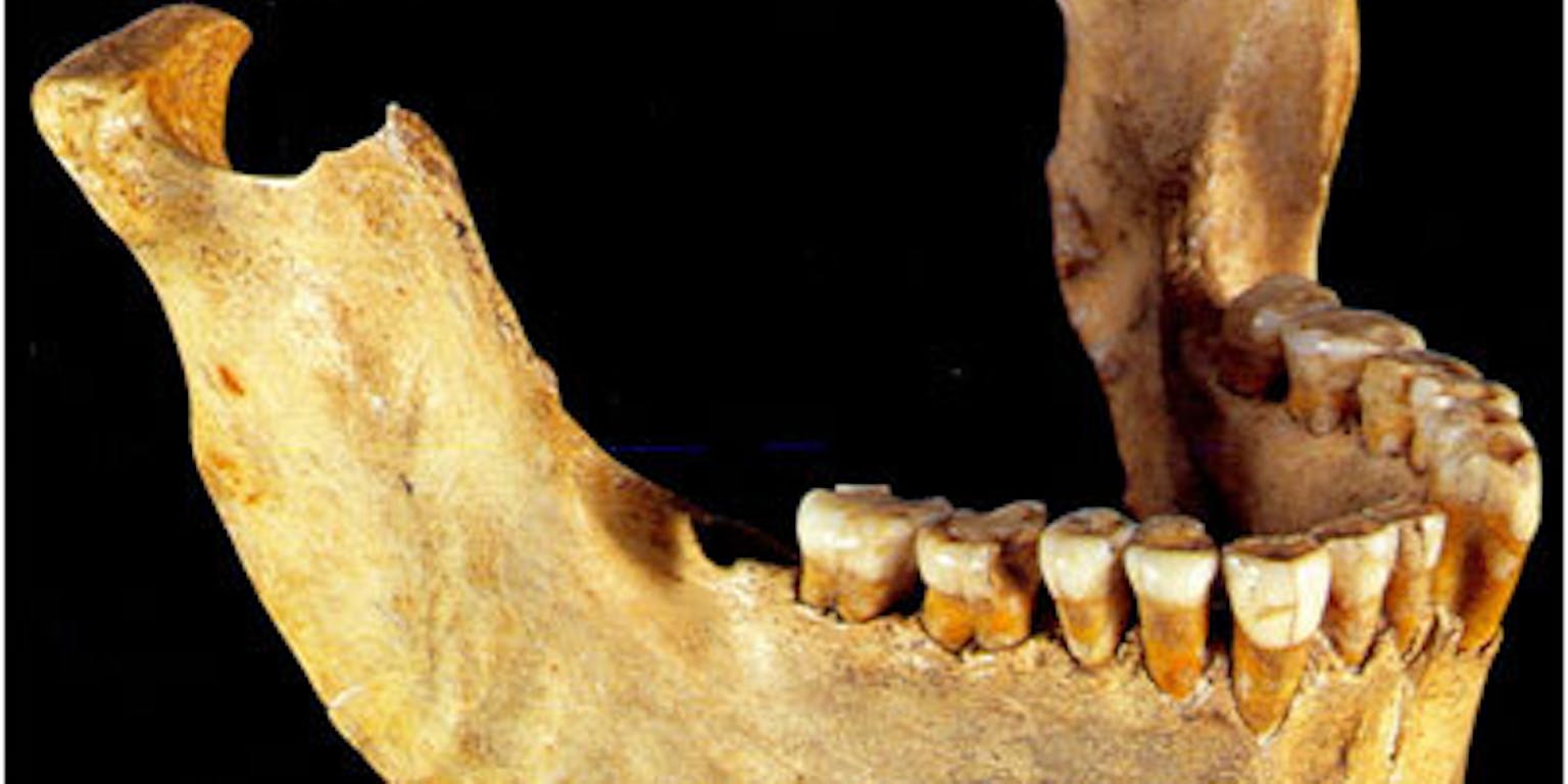 Een skelet van een menselijke kaak met tanden.