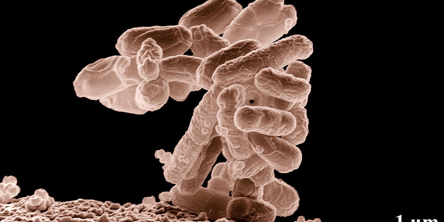 Een close-up van een darmbacterie op een zwarte achtergrond.