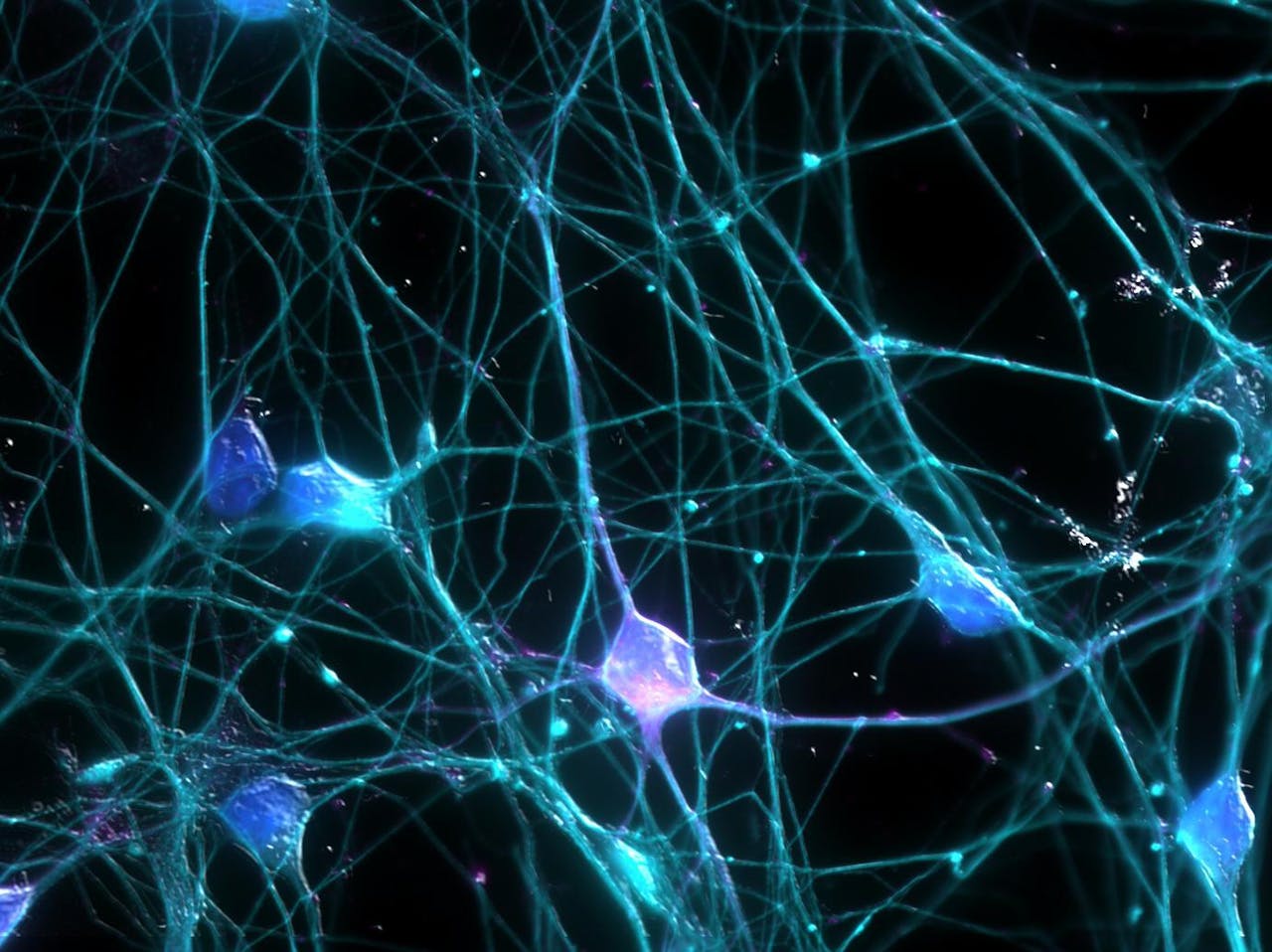 Een close-up van neuronen op een donkere achtergrond.