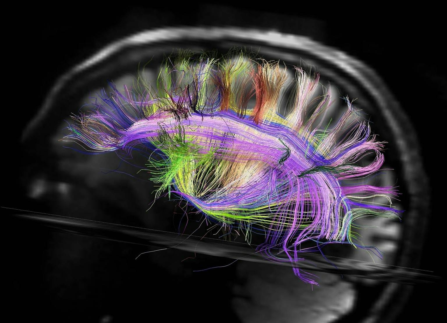 Een MRI-afbeelding van ons brein. De zenuwcellen en de verbindingen me andere cellen zijn kleurrijk weergegeven.
