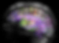 Een MRI-afbeelding van ons brein. De zenuwcellen en de verbindingen me andere cellen zijn kleurrijk weergegeven.