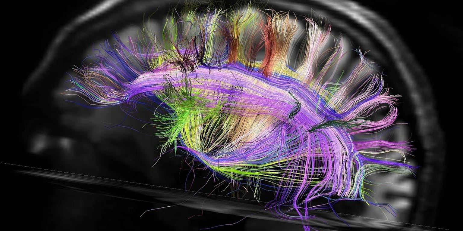 Een MRI-afbeelding van ons brein. De zenuwcellen en de verbindingen me andere cellen zijn kleurrijk weergegeven.
