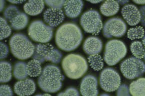 Een microscopische foto van bacteriën.