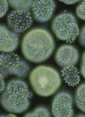 Een microscopische foto van bacteriën.