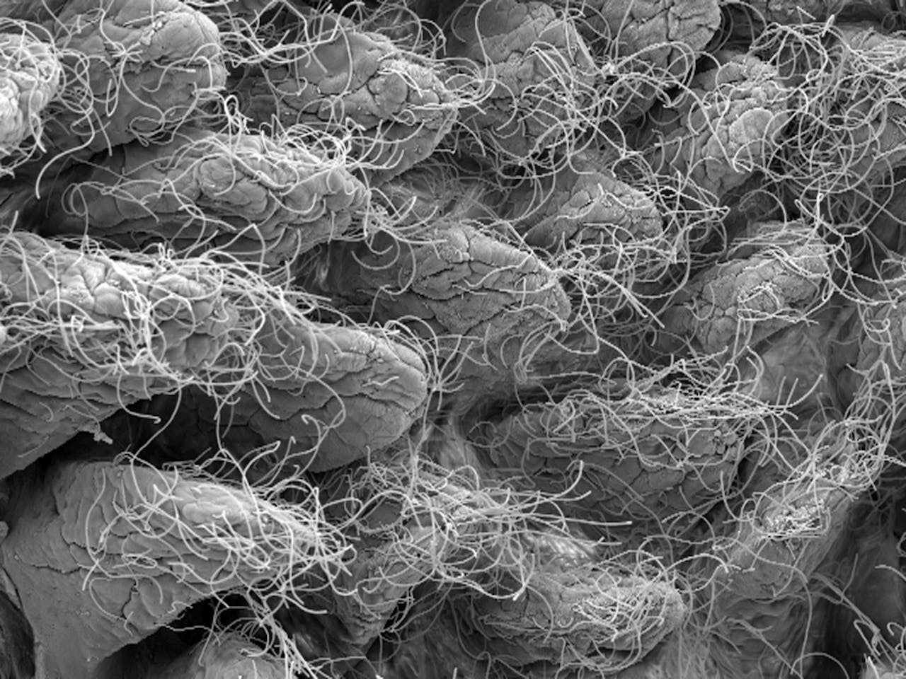Close-up van een darm met microben erop.