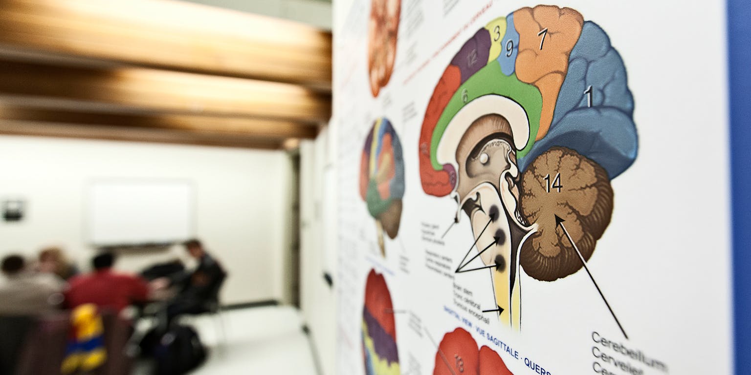 Een kleurrijke poster van het menselijk brein.