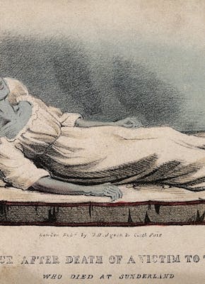 Een illustratie van een dode vrouw die op een bed ligt. Het lichaam is blauw aangelopen.