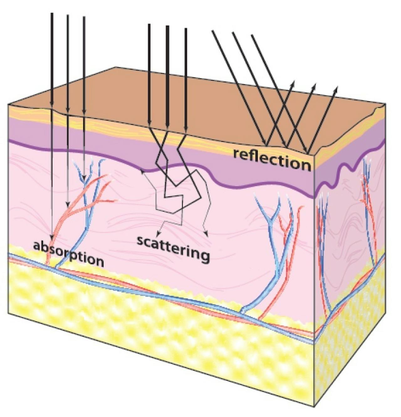 Een diagram dat de structuur van de huid laat zien.