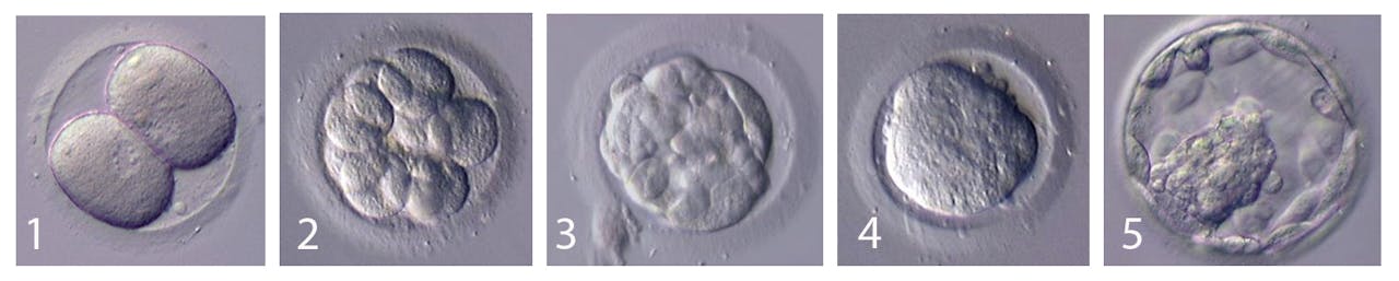 Een humaan embryo vanaf 2 cel stadium tot het blastocyst stadium