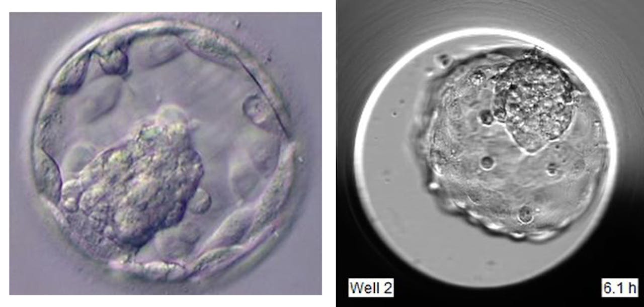 Humane blastocyst versus blastoïde