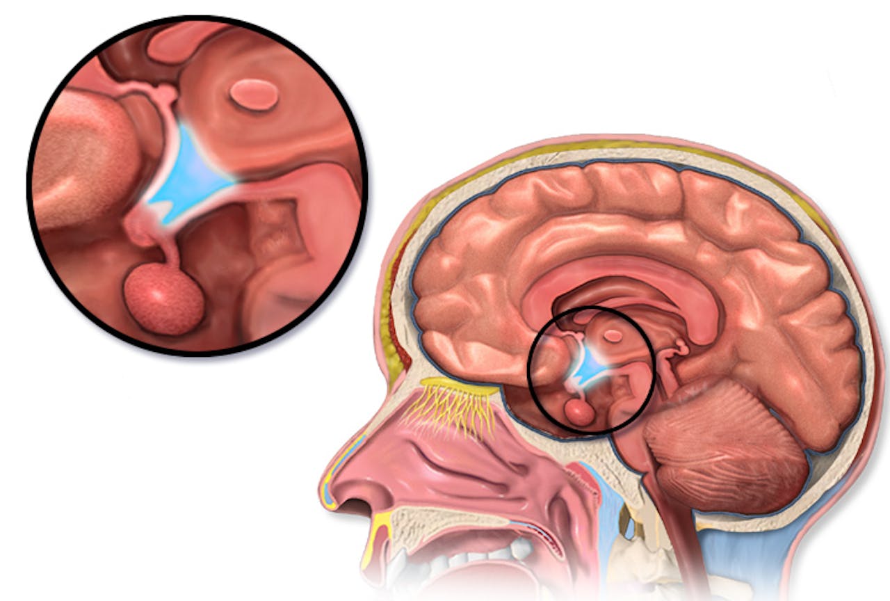 Een afbeelding van de hersenen waar de hypothalamus wordt uitgelicht.