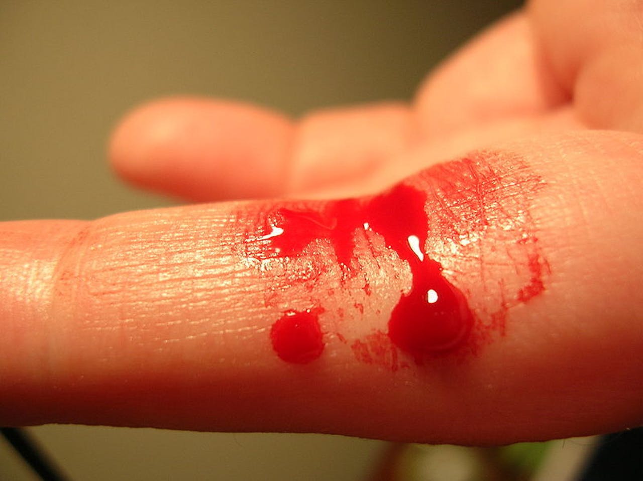 De vinger van een persoon met rood bloed erop.