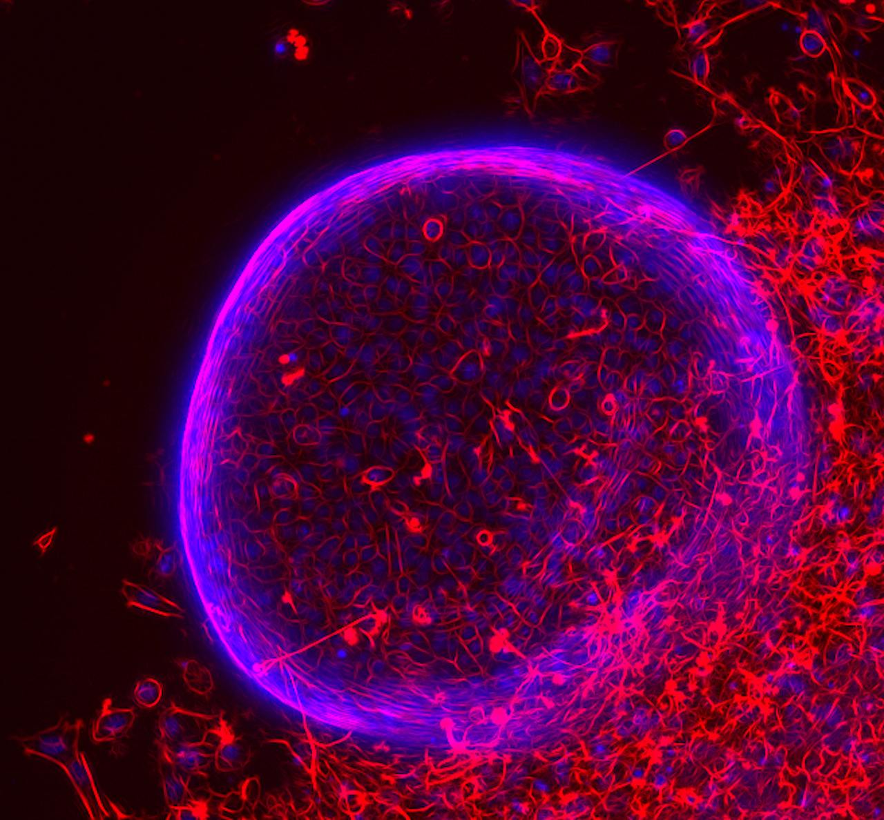 Kunstmatige cystes groeien in microscopische bakjes in het laboratorium.