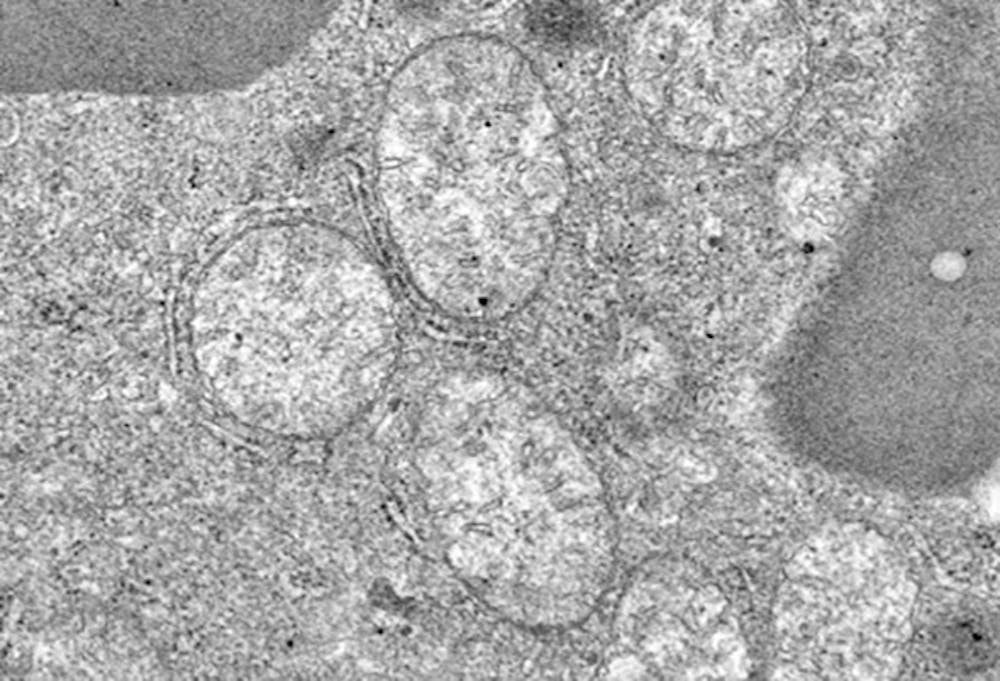 <p>Mitochondriën.</p>