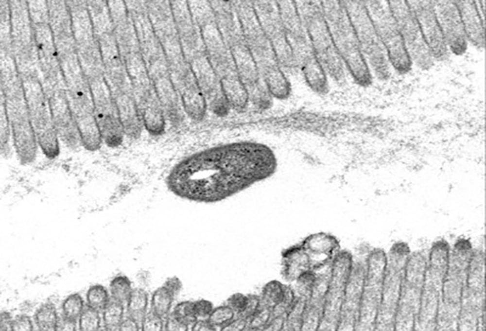 <p>Een bacterie in de darm.</p>