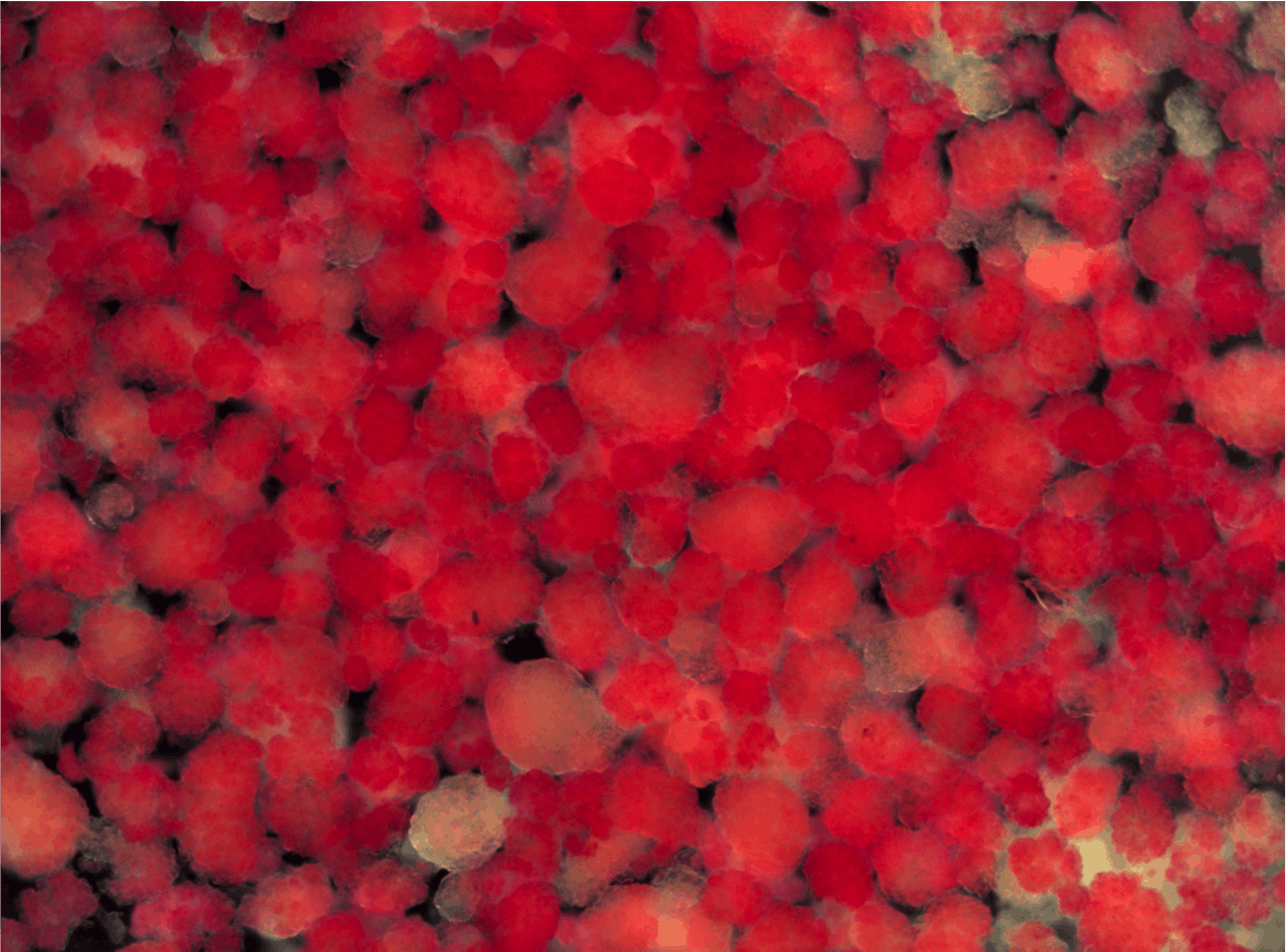 Eilandjes van Langerhans (in rood) kunnen uit de alvleesklier worden geïsoleerd en gescheiden van het overige weefsel. De diameter van een eilandje is ongeveer een tiende millimeter.