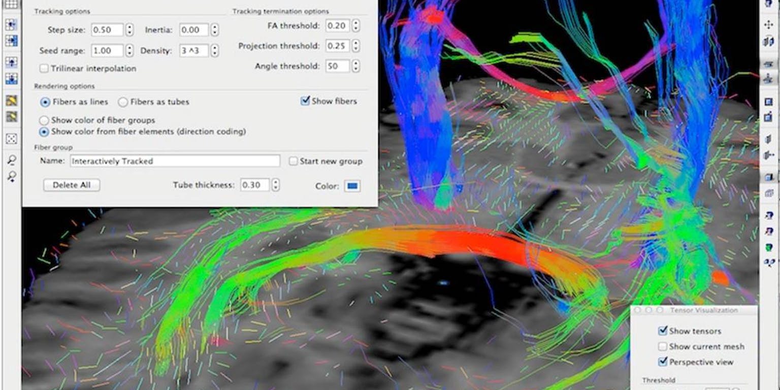 Een weergave van een aantal belangrijke zenuwbundels in het brein, in kleur wordt de oriëntatie aangegeven.