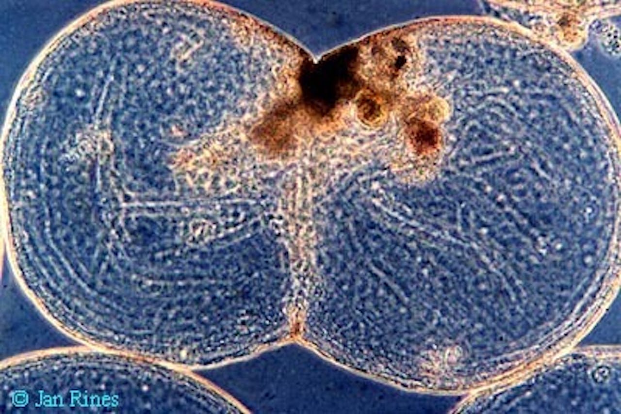 Een delende Noctiluca-cel. Deze alg veroorzaakt zeevonk.