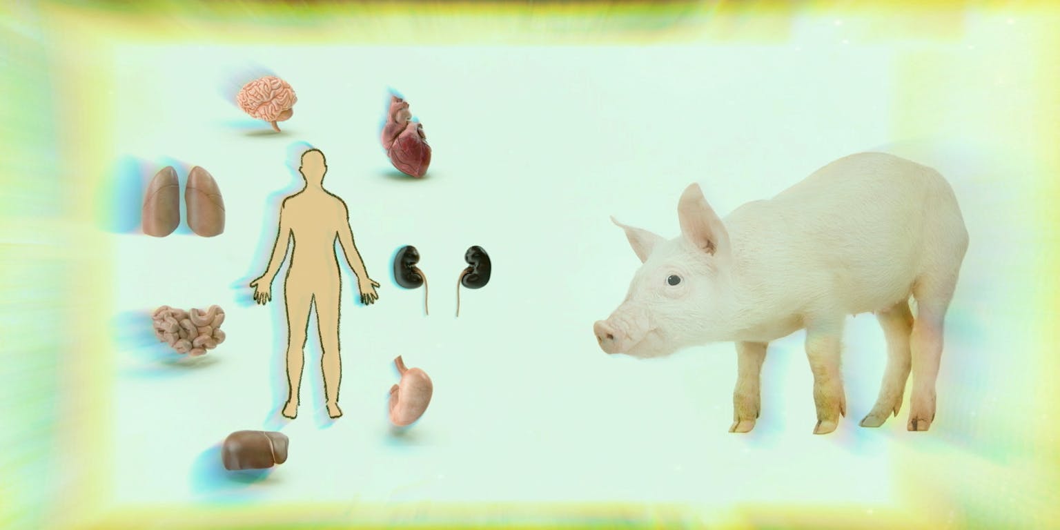 Een afbeelding van een persoon en een varken. De persoon is omringt met menselijke organen.