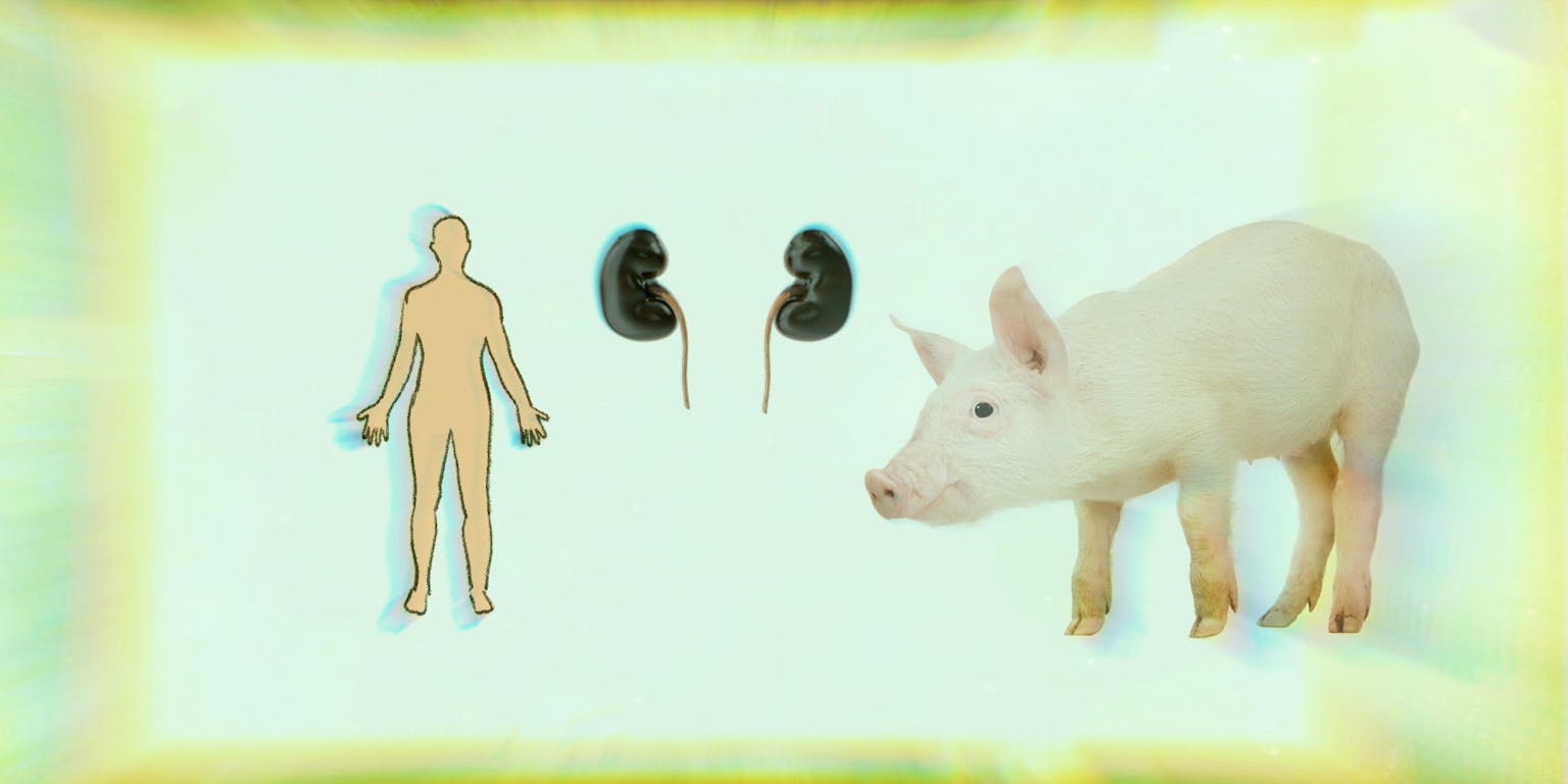 Een afbeelding van een persoon en een varken. Tussen hen zijn organen afgebeeld.