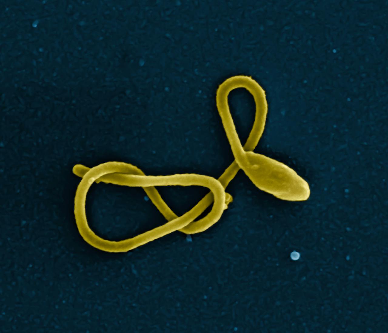 Ebola virus