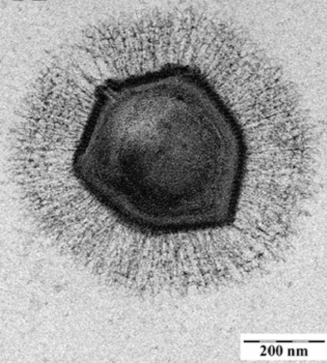 Zwart-wit beeld van een Mimivirus.