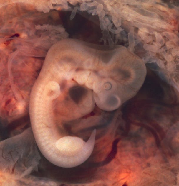 Een afbeelding van een embryo met een staart.