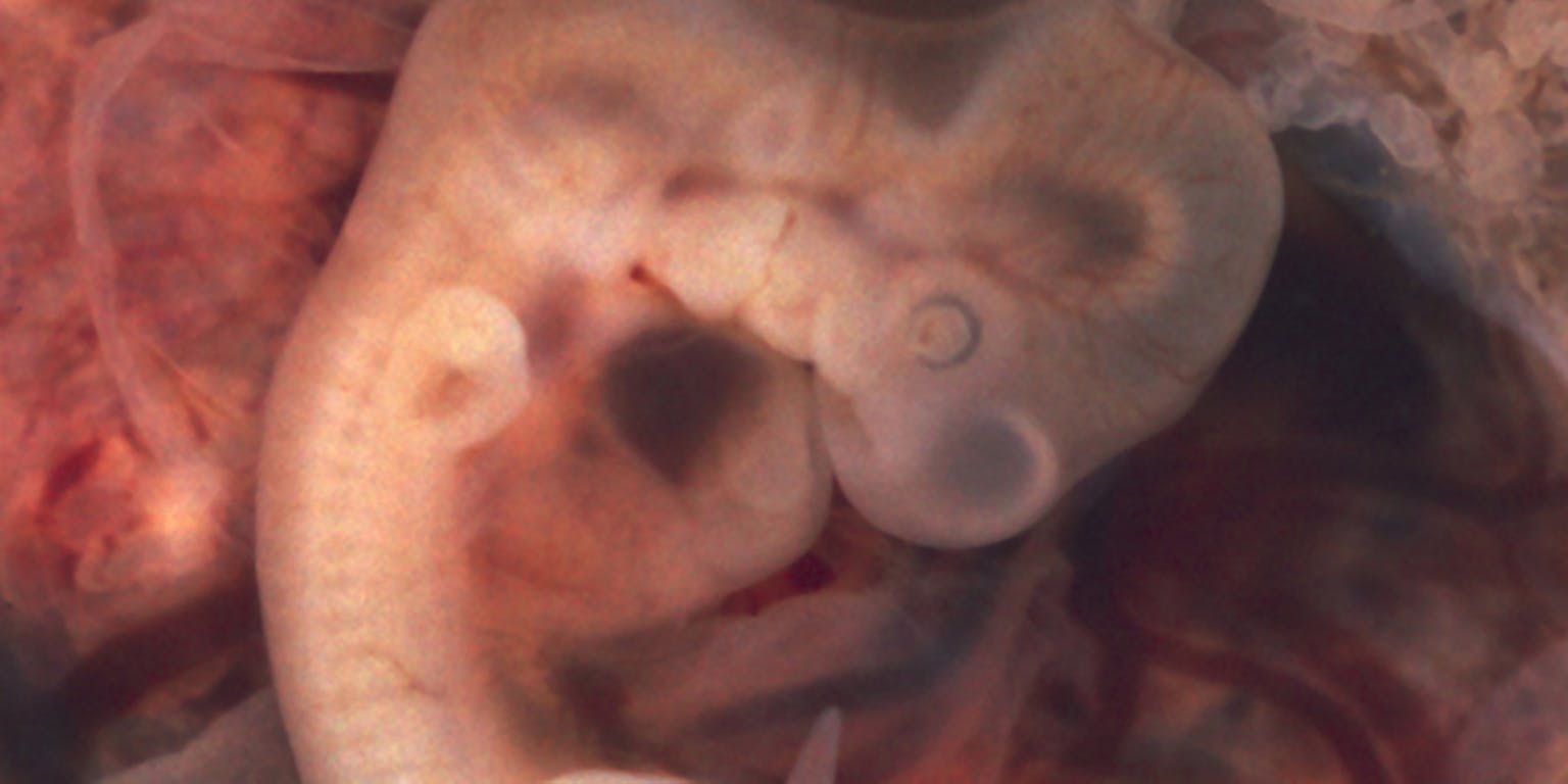 Een afbeelding van een embryo met een staart.