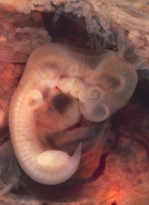 Een afbeelding van een embryo met een staart.
