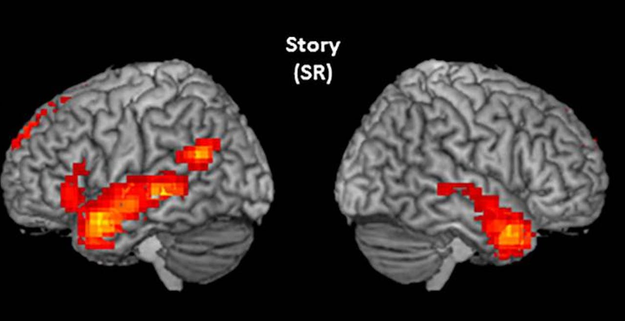 Activatie in de linker- en rechterhersenhelft van een kind weergegeven bij het horen van taal.