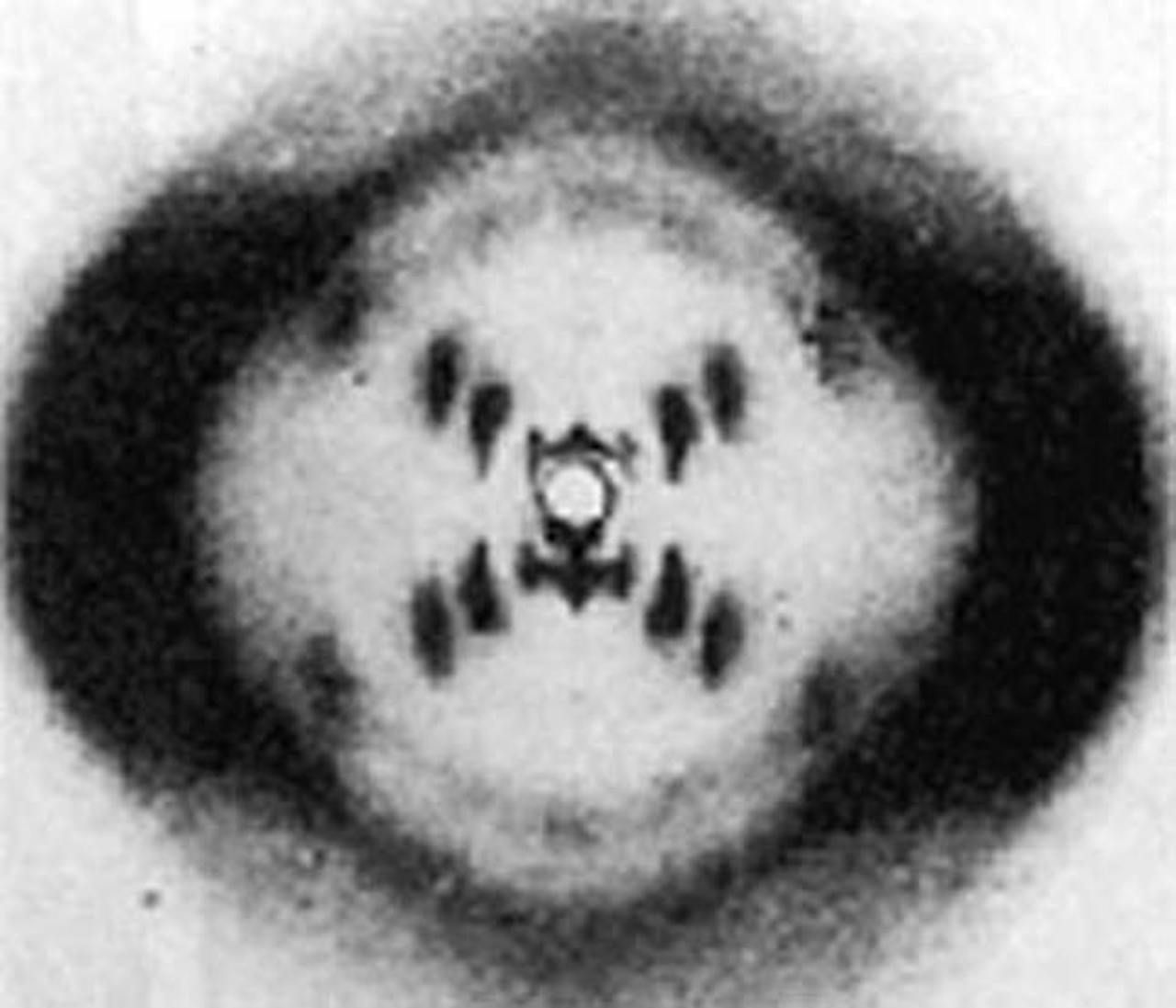 Röntgenfoto met zwart-wit beeld van dubbele helix-structuur.