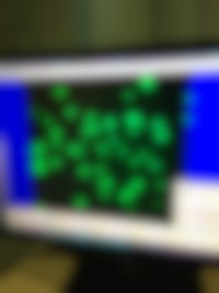 Groene druppeltjes op een zwarte achtegrond onder een microscoop.