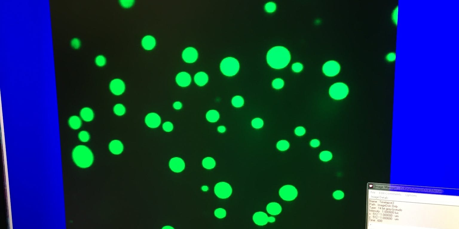 Groene druppeltjes op een zwarte achtegrond onder een microscoop.