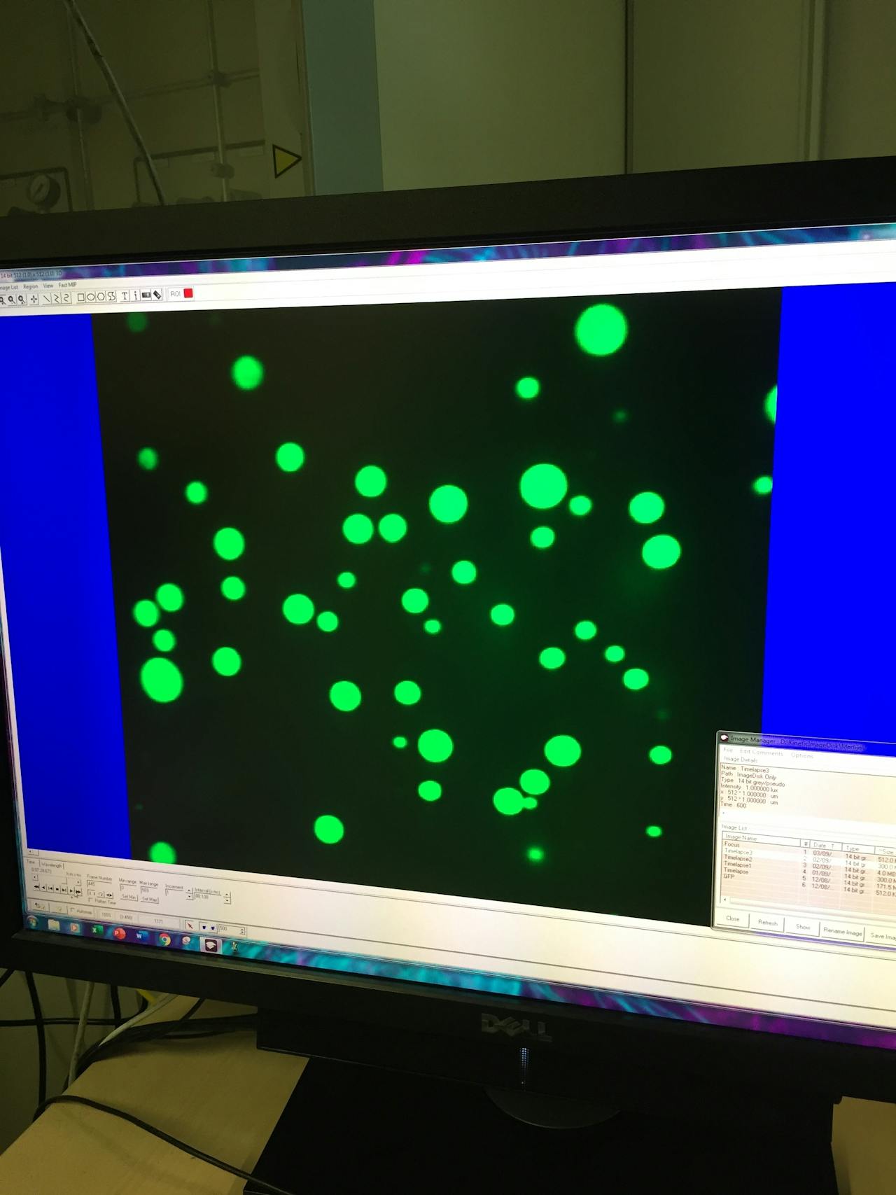 Groene druppeltjes op een zwarte achtegrond onder een microscoop.