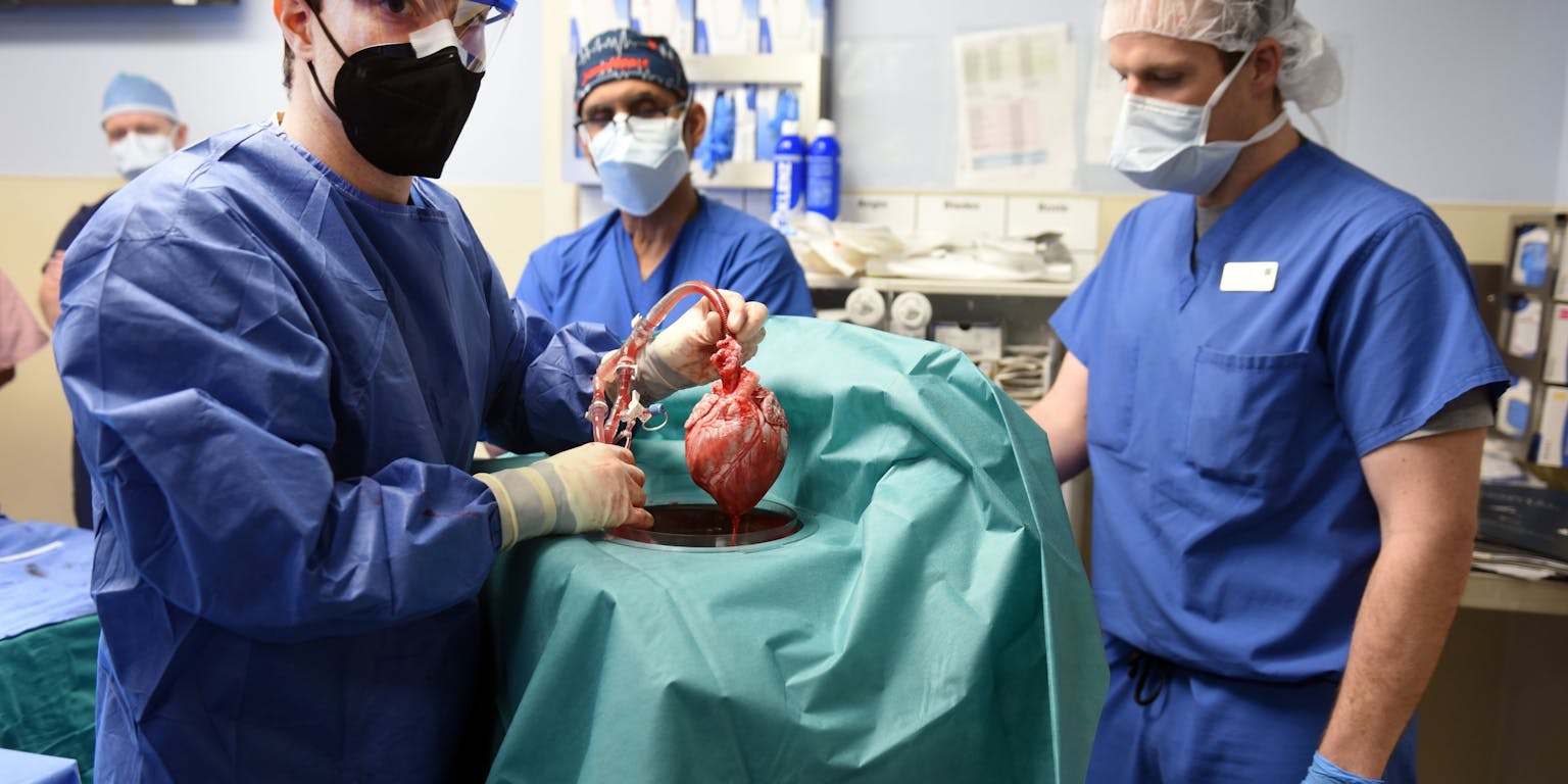 Een groep chirurgen in een operatiekamer. Zij houden een hart vast.