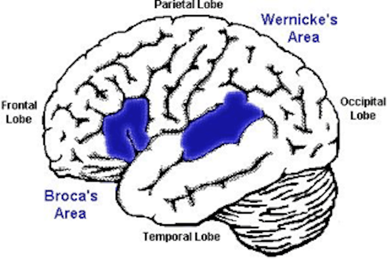 Een diagram van de hersenen dat de locatie van het gebied van Broca toont.