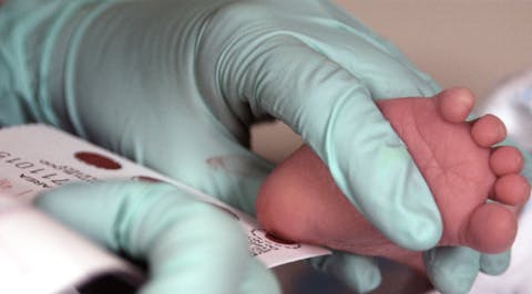 Sinds 1974 krijgen alle baby’s in Nederland de hielprik aangeboden. Daarbij wordt een beetje bloed uit de hiel op een kaartje gedruppeld voor labonderzoeken. Elk jaar spoort de hielprik bij ongeveer 225 kinderen een ernstige ziekte op. De schildklieraandoening congenitale hypothyreoïdie (CH) komt het vaakst voor, gevolgd door sikkelcelziekte en taaislijmziekte. Een arts druppelt een beetje bloed uit de hiel van een baby op een papieren kaartje.