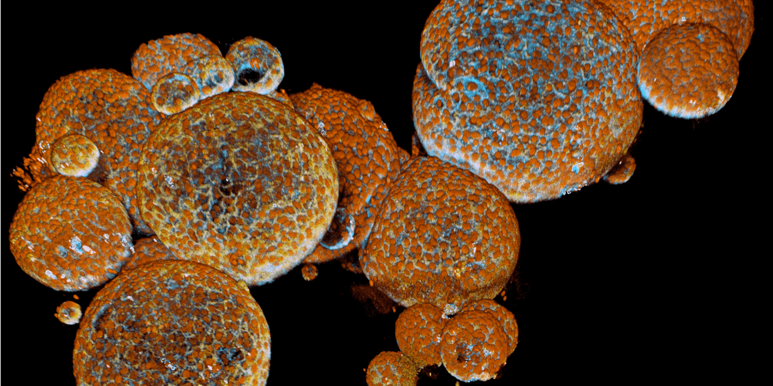 Een close-up van kleine gifkliertjes, die in een laboratorium zijn gemaakt uit het gif van negen slangen.