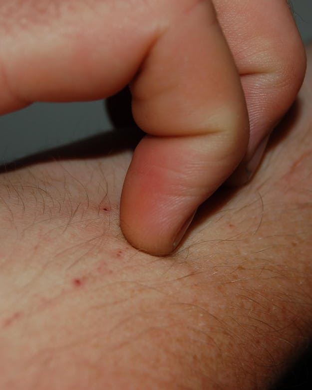 De arm van een persoon met een kleine kras erop.