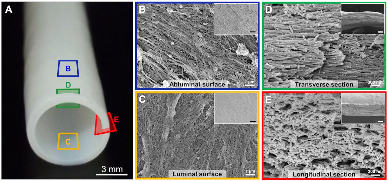 De HAV (links) nadat de cellen zijn verwijderd en voorafgaand aan implantatie in het lichaam. De vier detailopnamen rechts zijn met een scanning electron microscope (SEM) gemaakt en sterk uitvergroot. De structuur van de matrix komt goed overeen met die in een echt bloedvat.