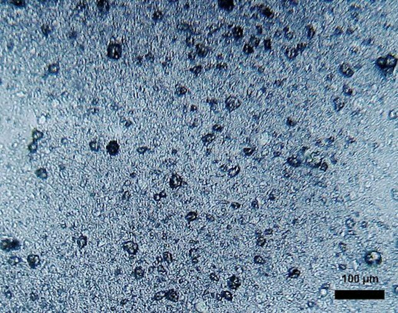 Een close-up beeld van microscopisch kleine bolletjes van poly-ethyleen in tandpasta.