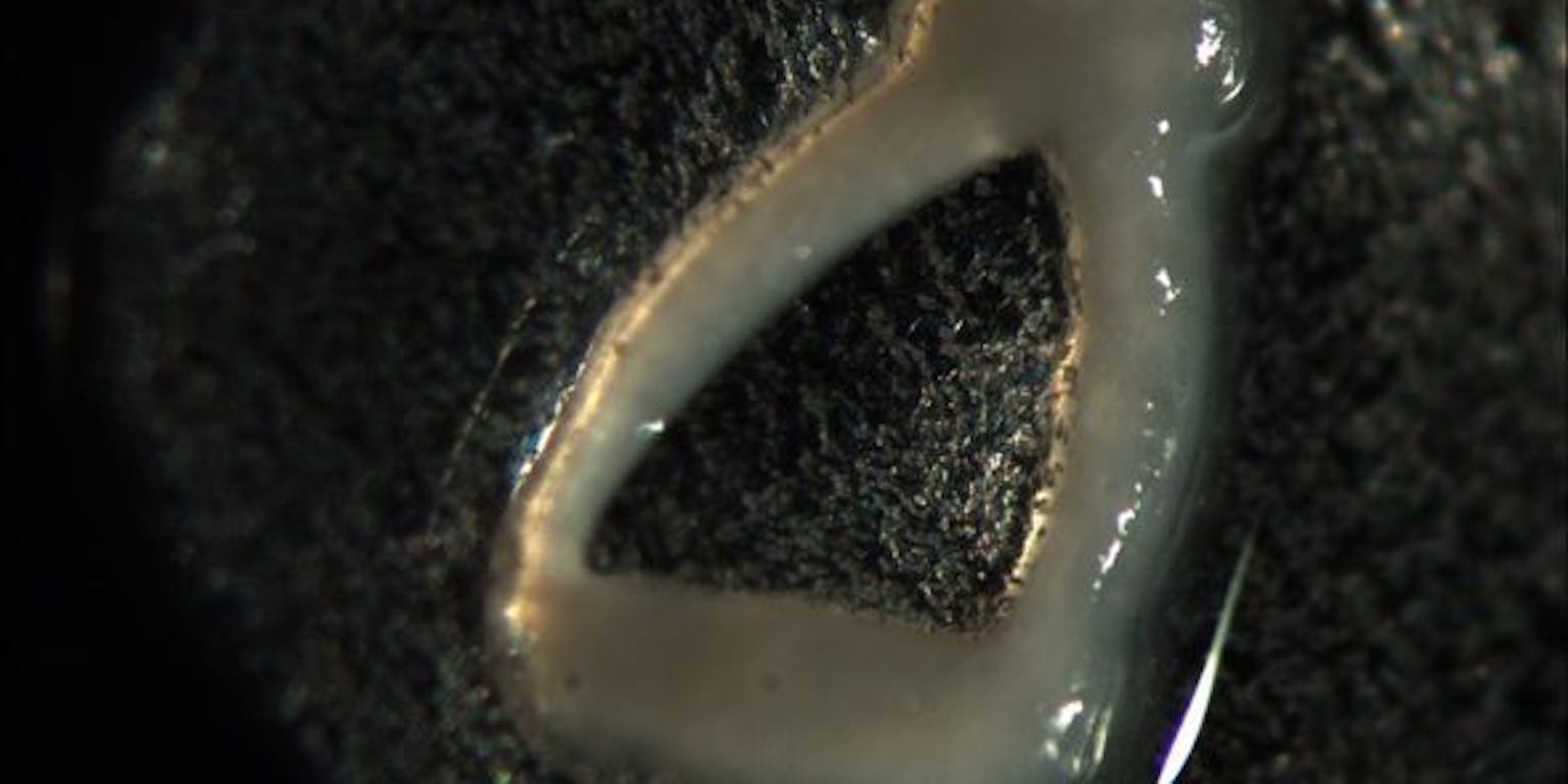 Een gehoorbeentje, gemaakt van kraakbeen.