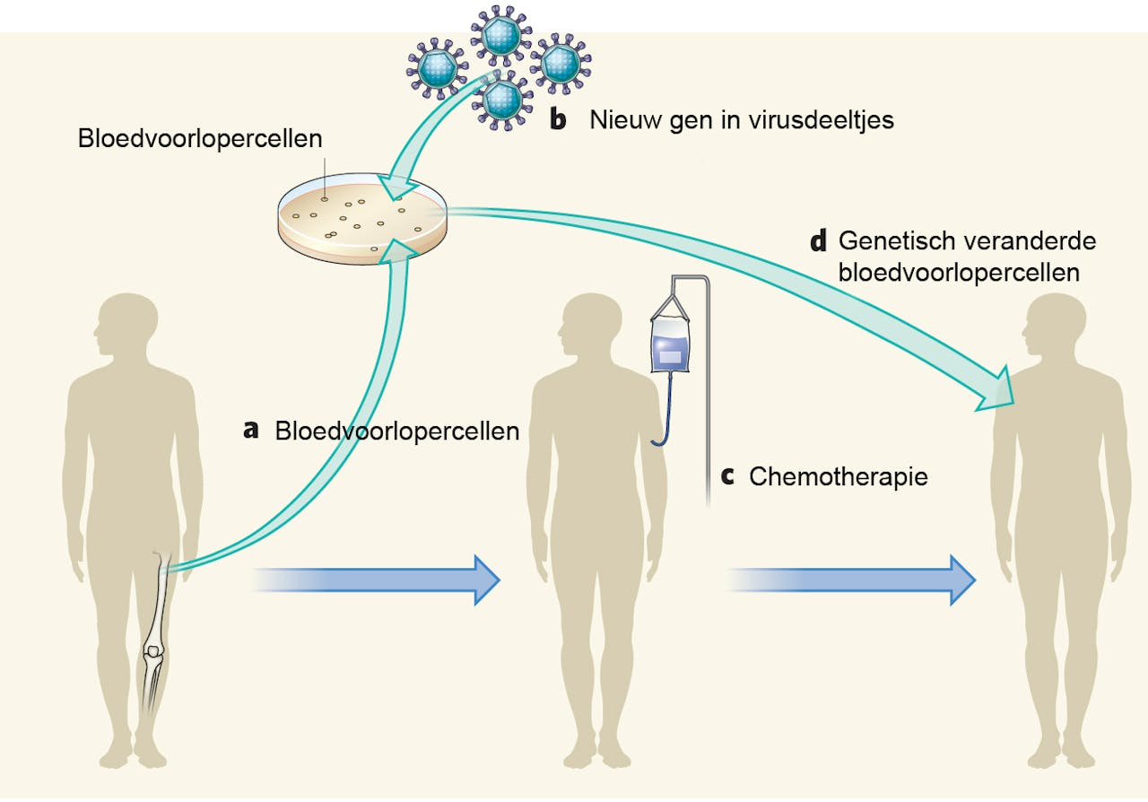 Bij gentherapie worden virussen gebruikt om menselijke genen in te verpakken.