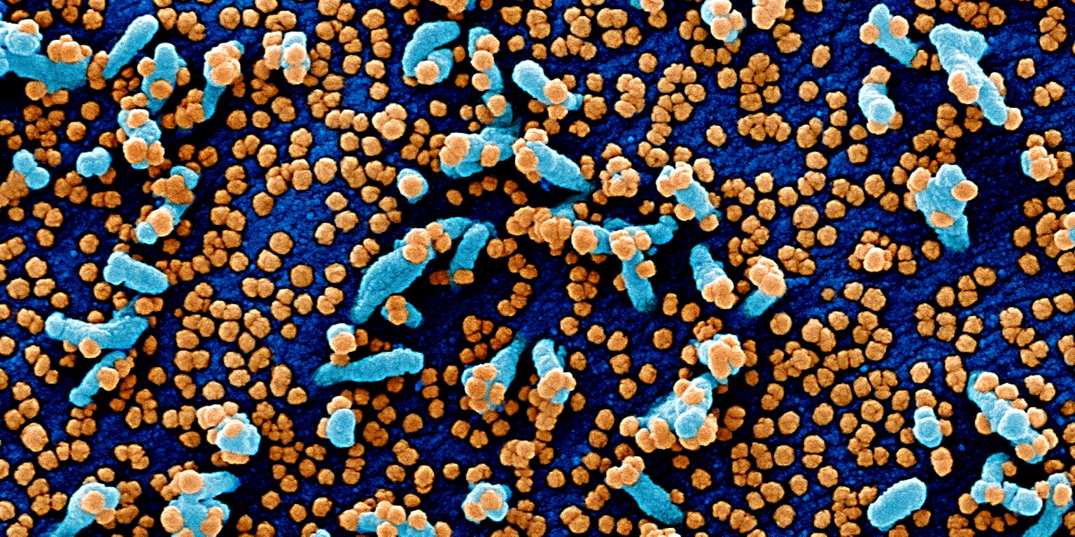 Visualisatie van het coronovirus